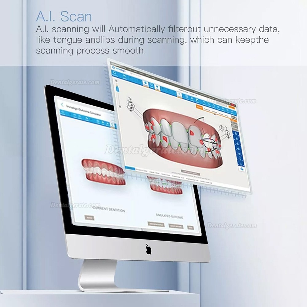 INO100 Intraoralscanner Zahnarzt /3D Digitale Zahnabdr&uuml;cke mit Software
